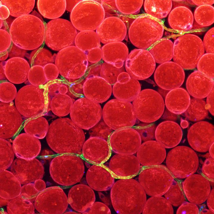 Figure 1 Expression of fatty acid transporters in blood vessels