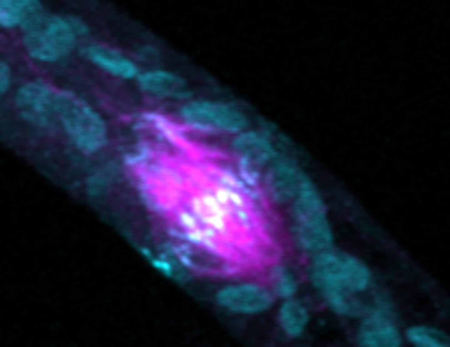 Phragmoplast with Microtubules and Myosin