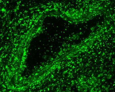 Cell Proliferation in Hard Environments (2 of 3)