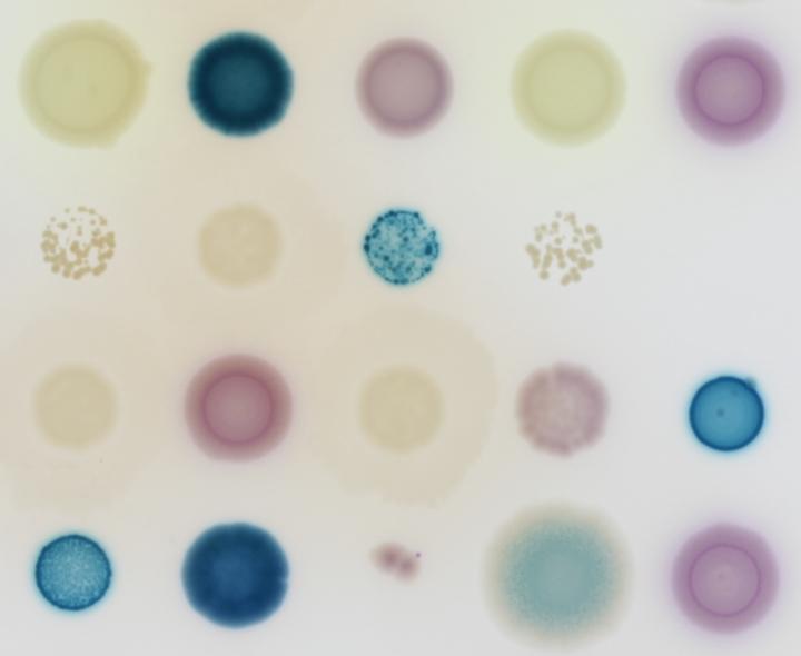 Infectious Bacteria Grown on Diagnostic Agar