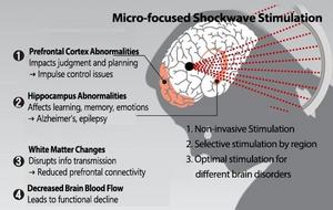 Figure 1. Key Features of Micro-Shockwave Brain Disorder Treatment