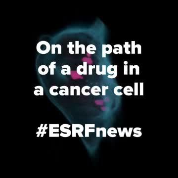 Revealing the Path of a Metallodrug in a Breast Cancer Cell