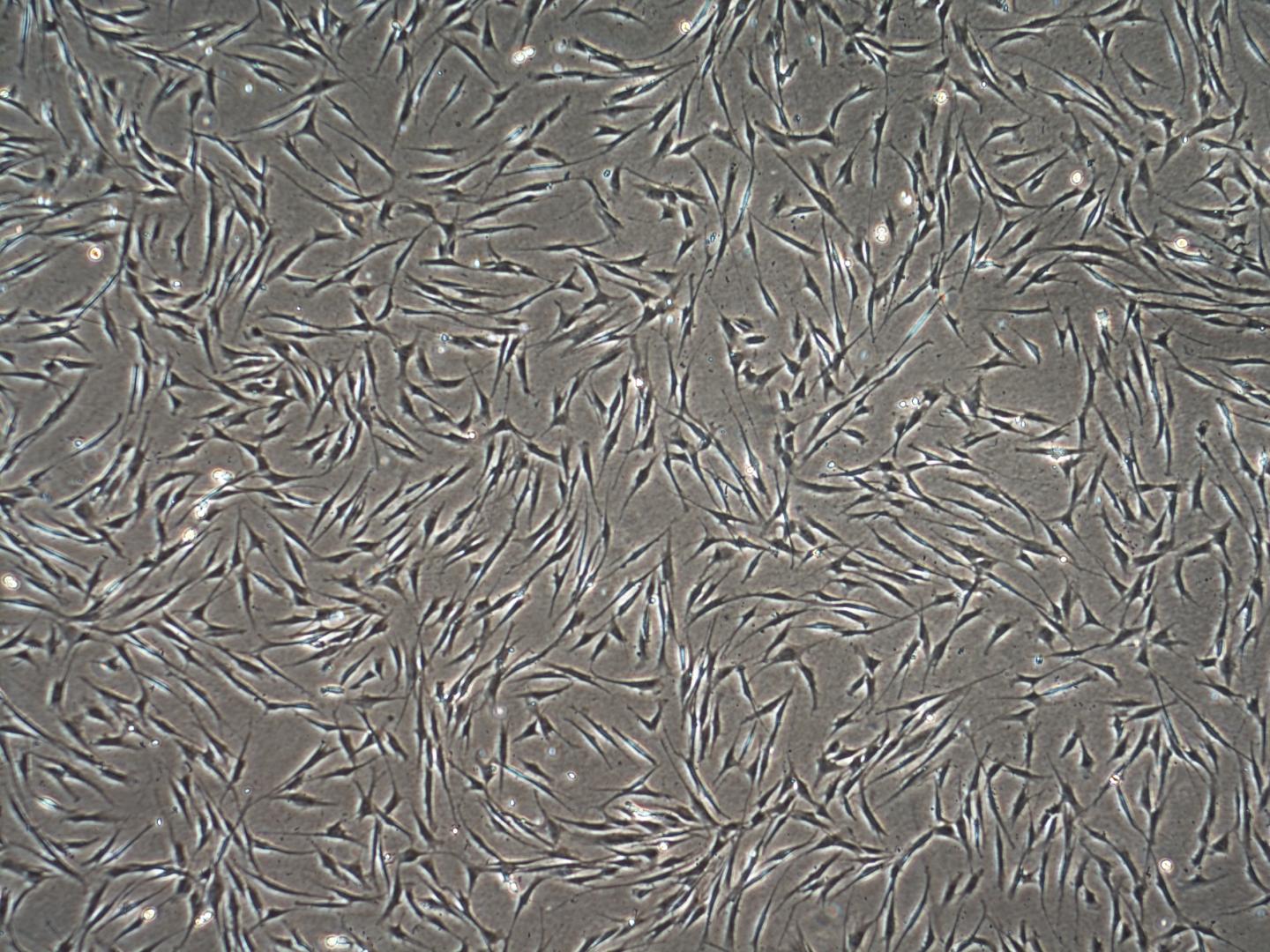 Fibroblasts