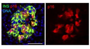 Adult pancreatic islets marking senescent beta cells