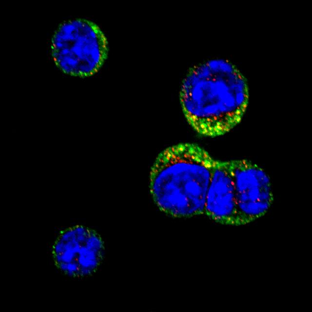 B Cells Change Their Genes to Make Antibodies