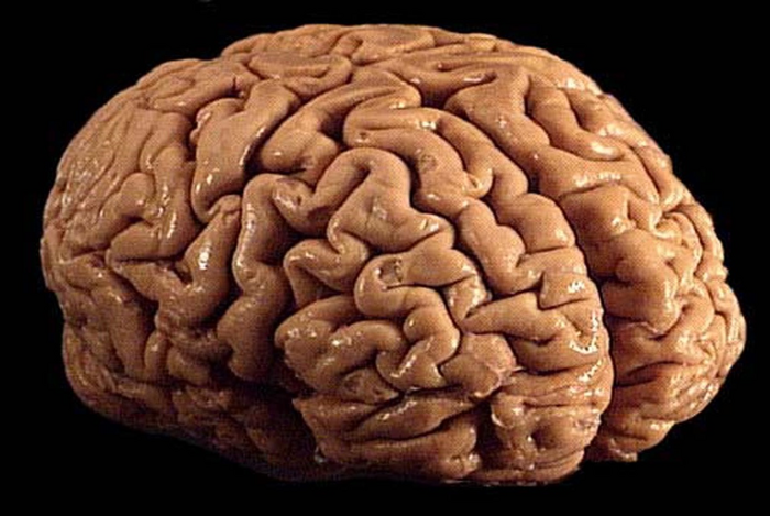 Brain wrinkle