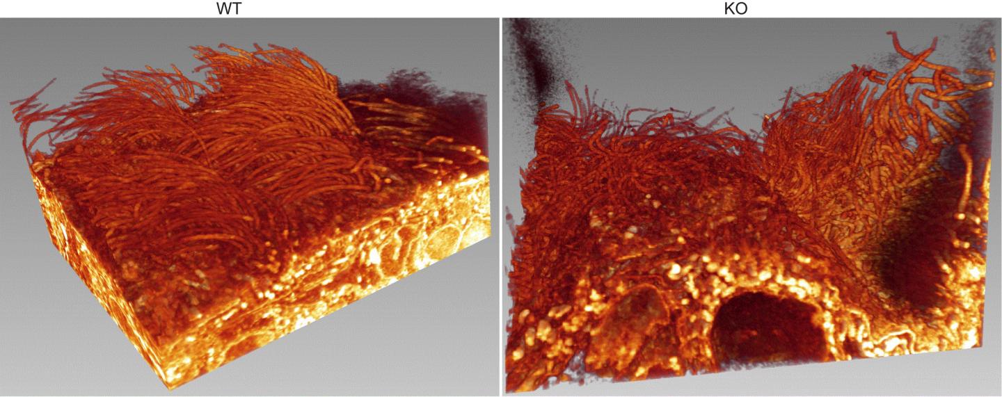 Loss of Alix Protein also Affects Cilia of the Ependyma