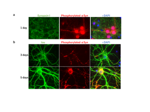 Fig.2　 Seed-dependent phosphorylation of α-synuclein in mouse primary-cultured neurons.