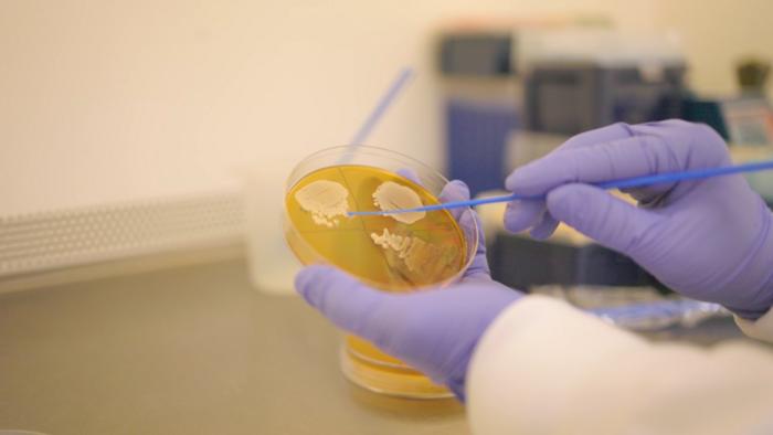 Picking yeast from a plate