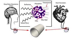 The authors combined graphene, polypropylene, and nanoclay to create novel biomaterials