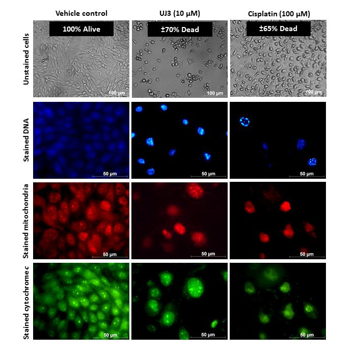 How a Promising Silver-Based Complex Targets Human Cancer Cells