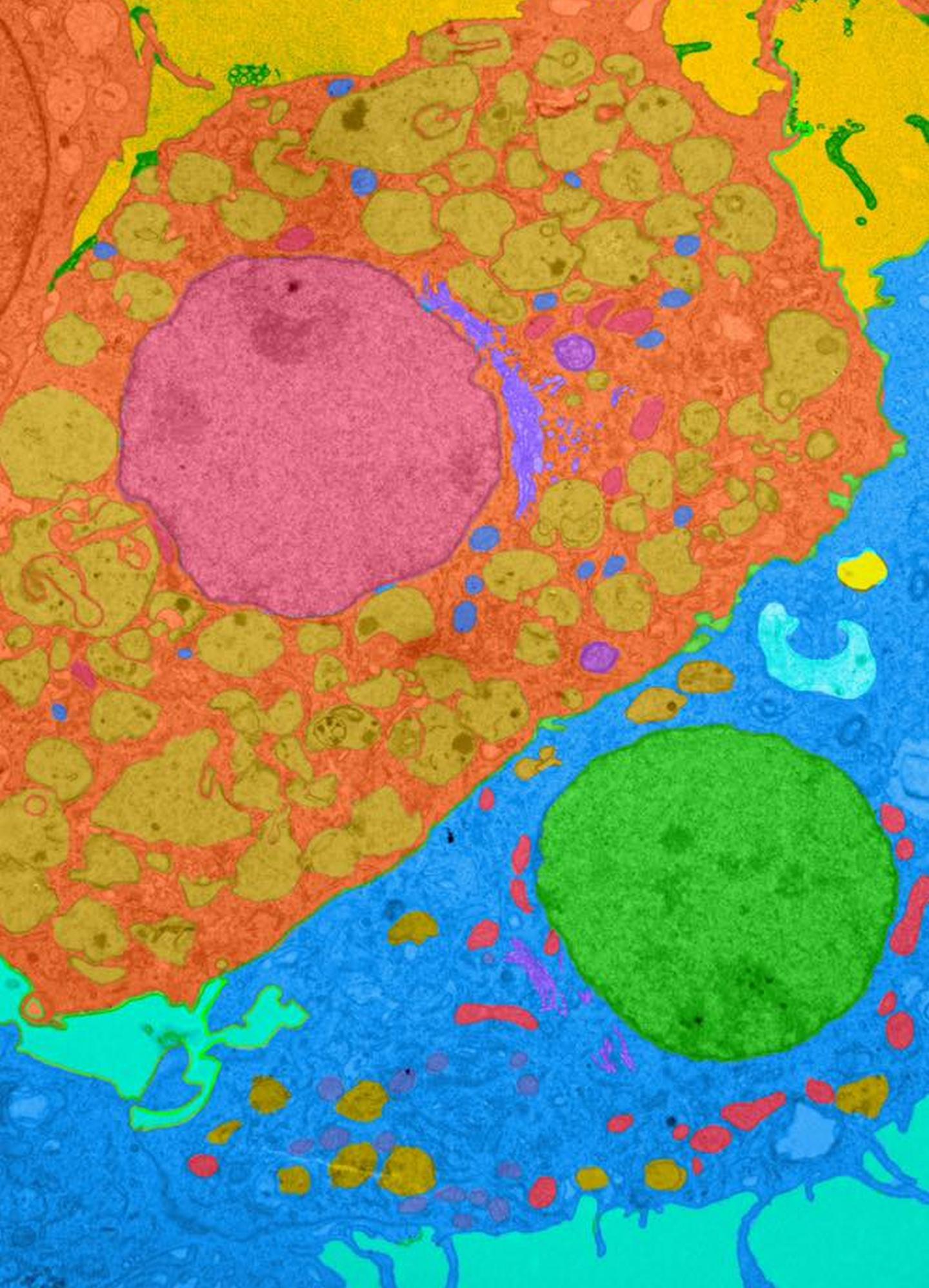 Cardiac Fibroblast and Macrophage