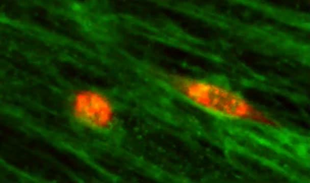 Following the Highway: JHU Cells on CAF-CDM