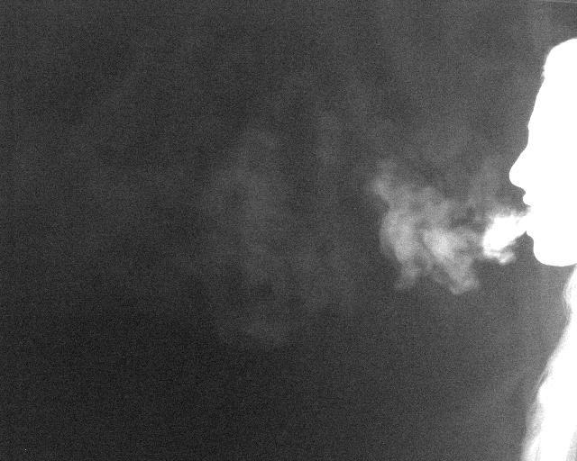 How Speech Propels Pathogens