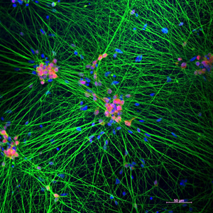 human stem cell-derived neurons in a dish