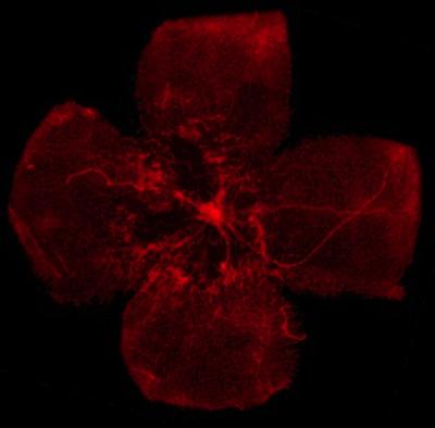 Retinal Blood Vessels