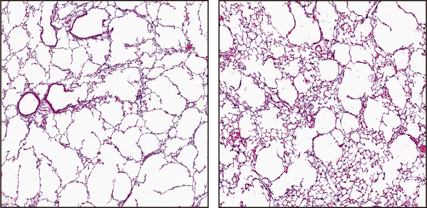 Injection of healthy lung endothelial cells reverses tissue destruction in mice with emphysema