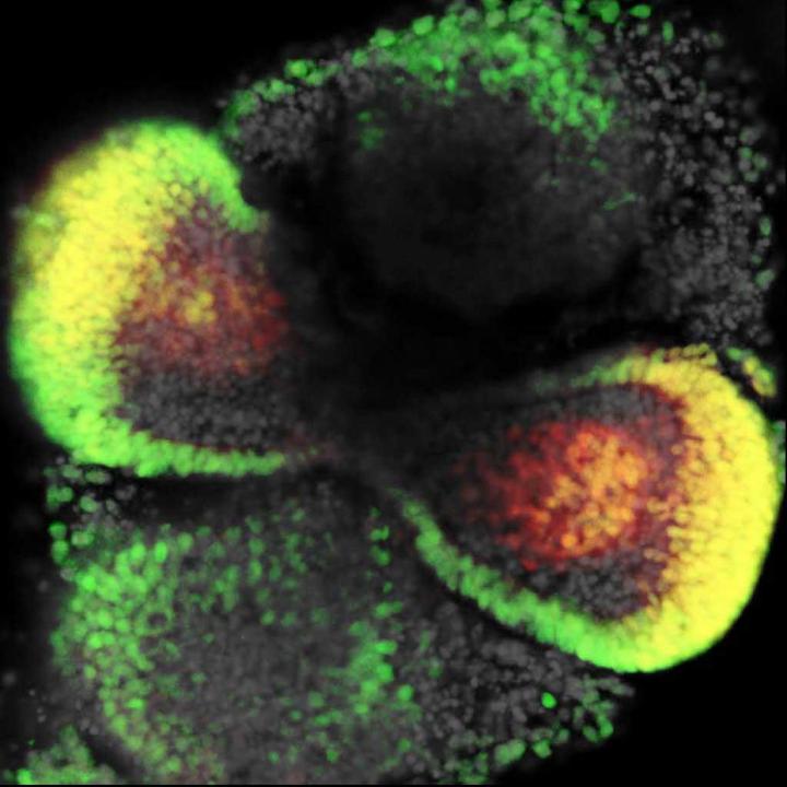 Looking Retinal Development Straight into the Eye