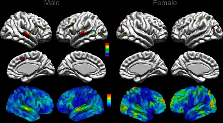 Regions of Significant Differences in the Brain in Males and Females with Autism
