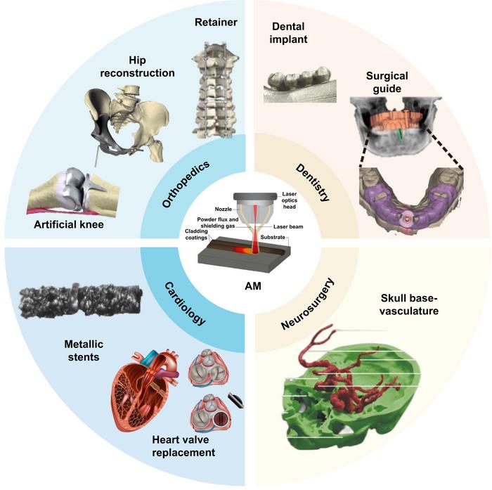 Additive Manufacturing of Biomedical Metals for Medical Implant Fabrication