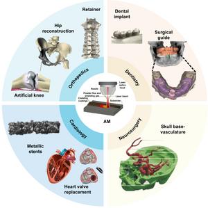 Clinical application schematic of additive manufacturing in medical metal implants