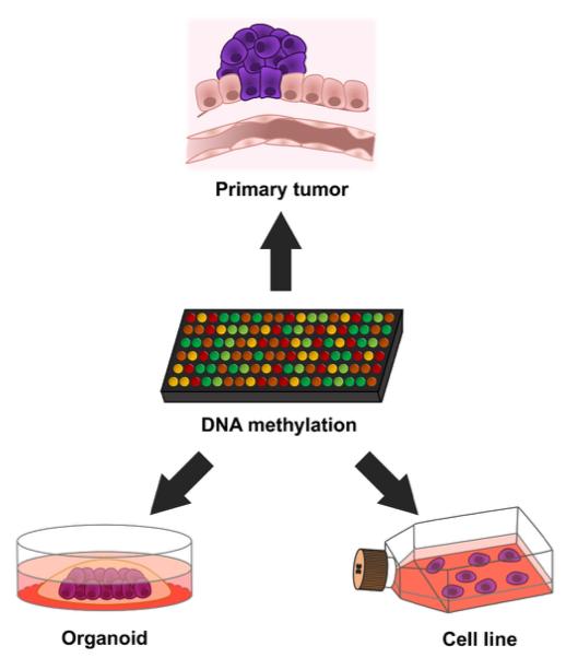 Human Cancer Models Studied at the Epigenetic Level