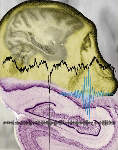 Hippocampal Oscillations