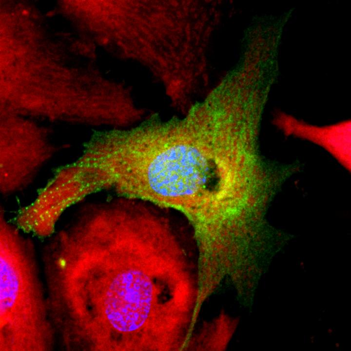 Heart Muscle Cells