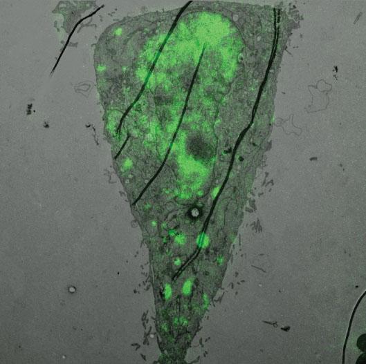 Epithelial Cells Infected with Influenza Virus