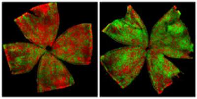 X Chromosome Silencing in Left and Right Retinas