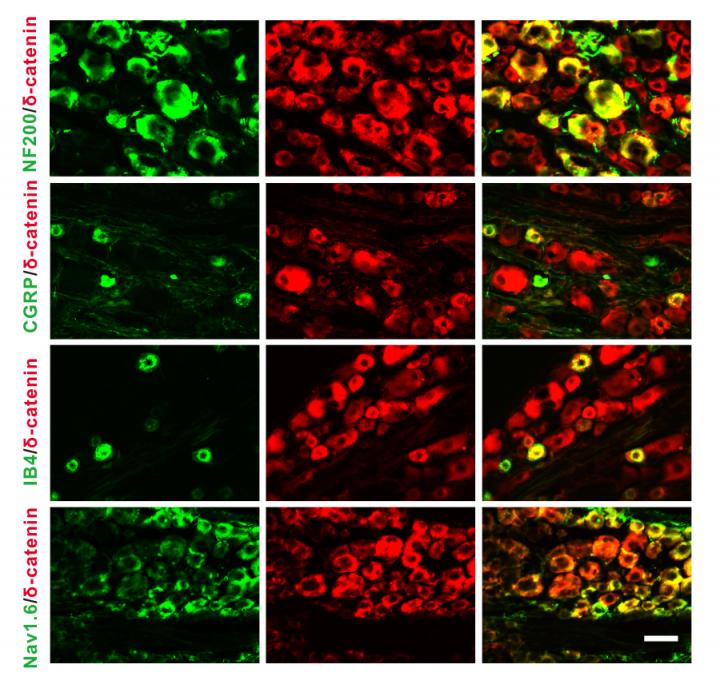 A Protein Modification Gets to the Root of Chronic Pain in Rats (1 of 2)