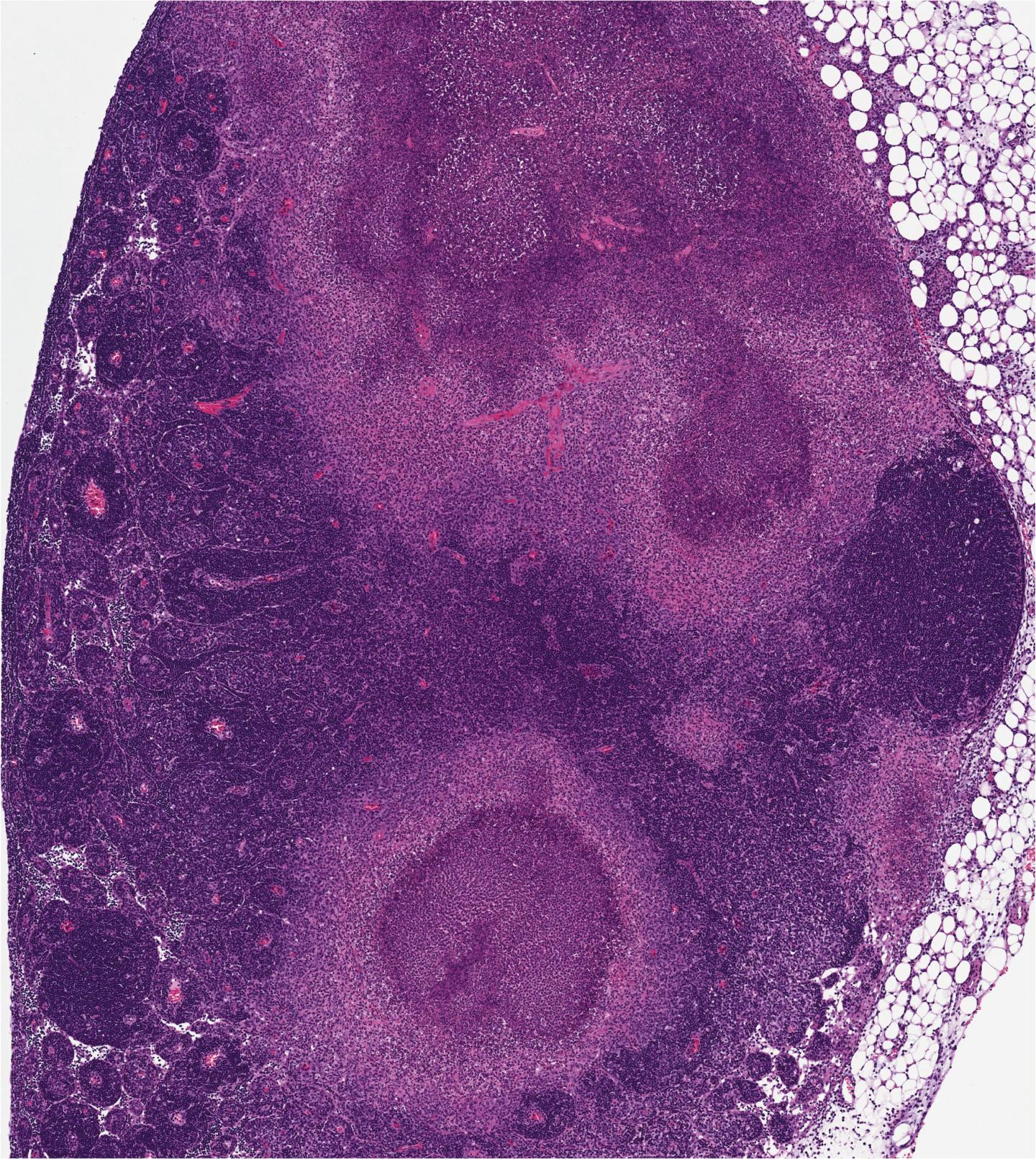 Subverting a Pathogen's Strategy