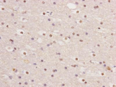 Temporal Neocortex, Epilepsy Patient