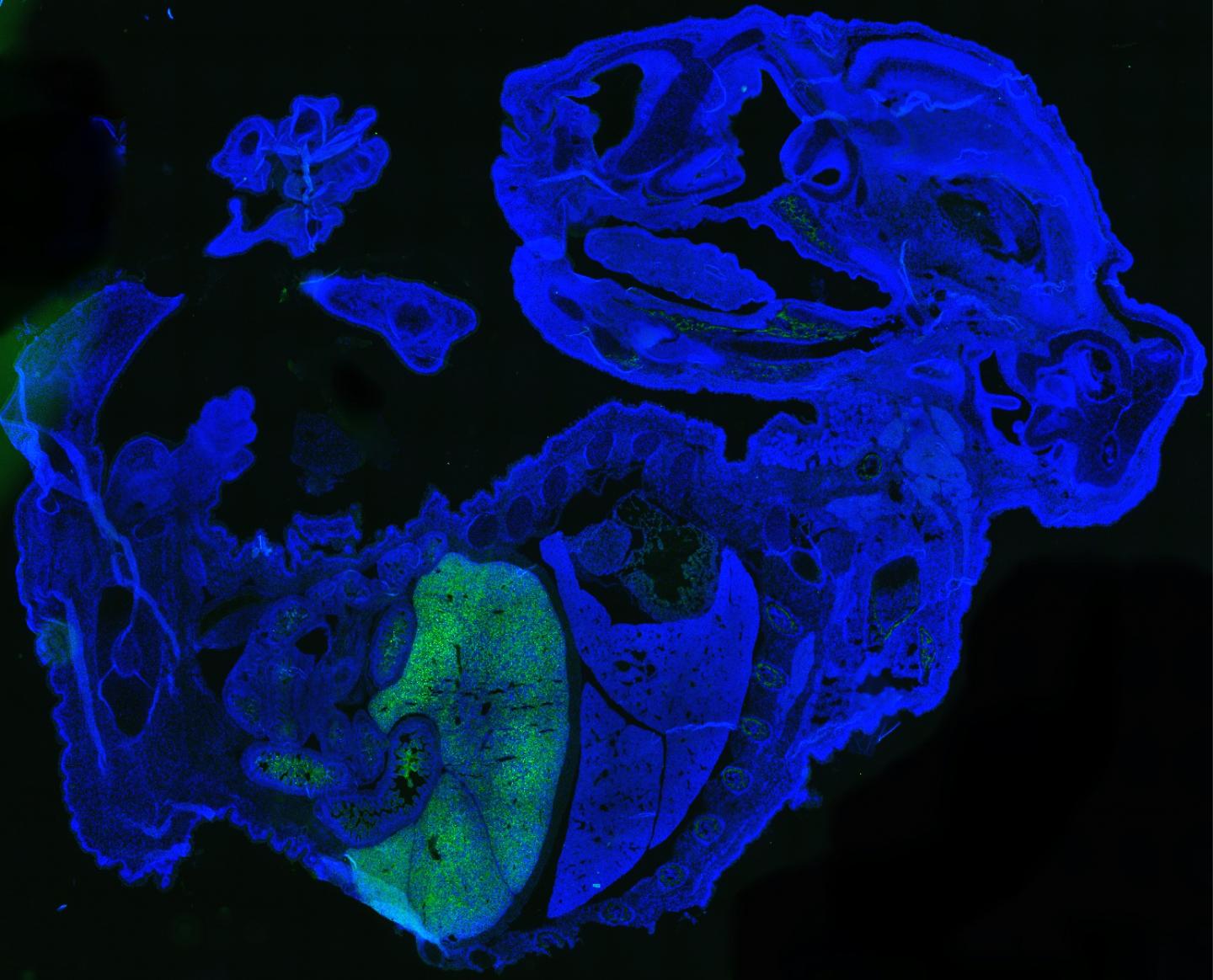 Human cells in a mouse embryo