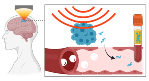 focused-ultrasound-mediated liquid biopsy