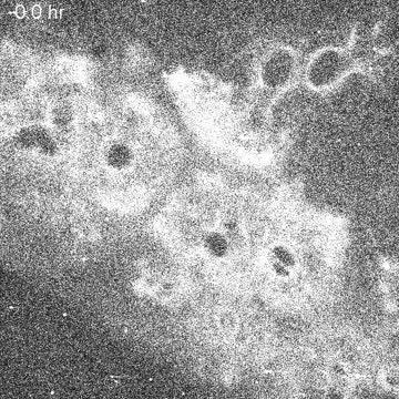 Body Clock in Lung Tissue