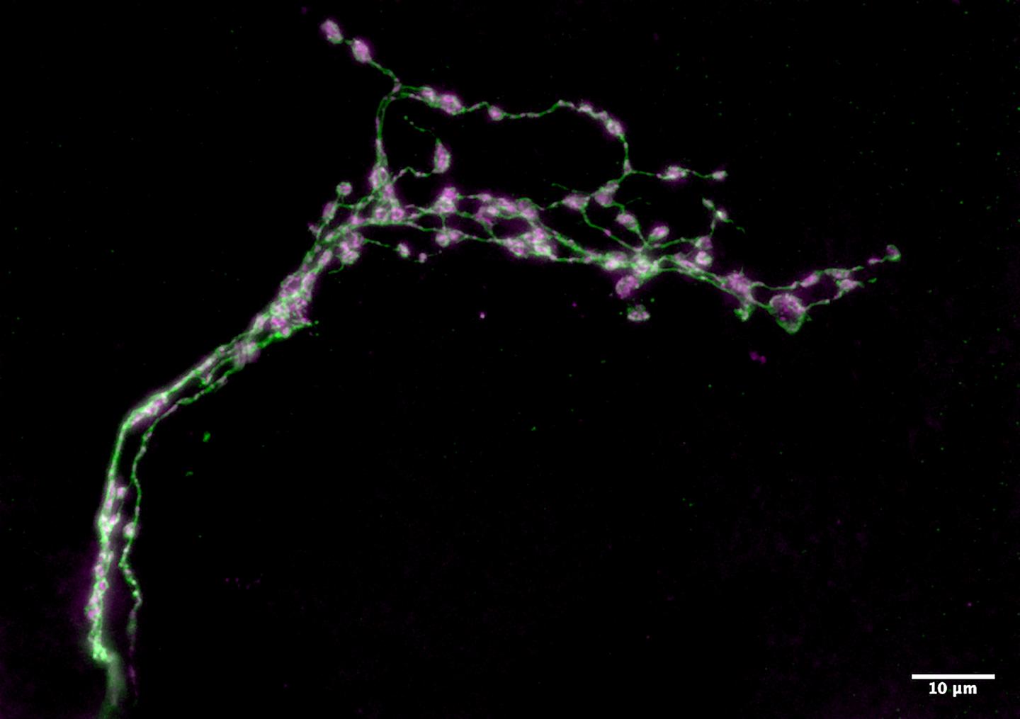 Dorsal Medial Termini Neuron Segments