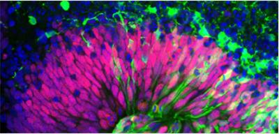 Human Forebrain Organoid