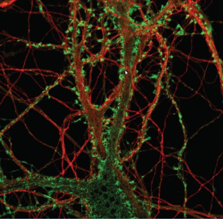 How Prions Kill Neurons: New Culture System Shows Early Toxicity to DendriticSspines