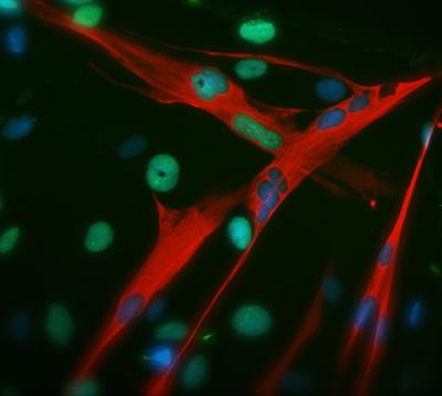 Image of Differentiated Salamander Muscle Cells Re-entering the Cell Cycle