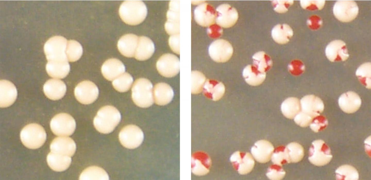 Yeast Cells Can Clear Amyloid