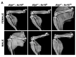 Radiographic analysis