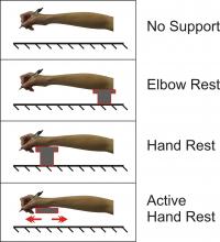 Four Forms of Arm Support