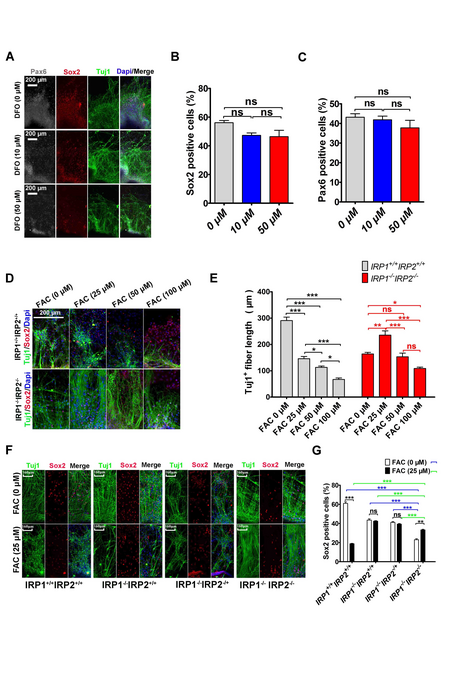 Iron is an important factor for neurodifferentiation