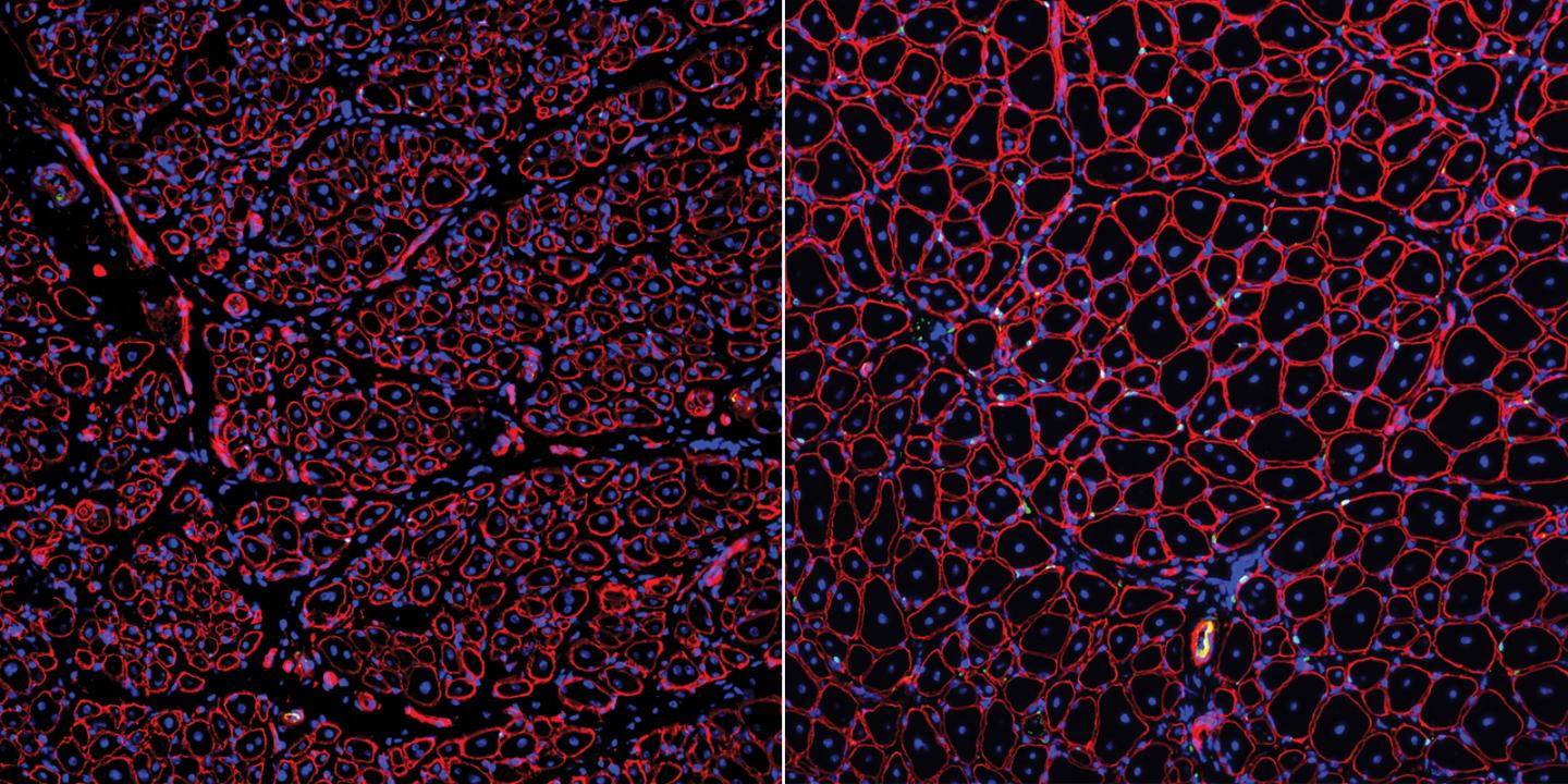 GDNF Restores Muscle Stem Cell Function and Muscle Regeneration