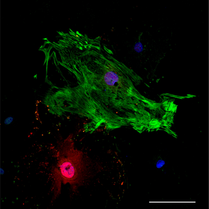 Cardiac muscle cells