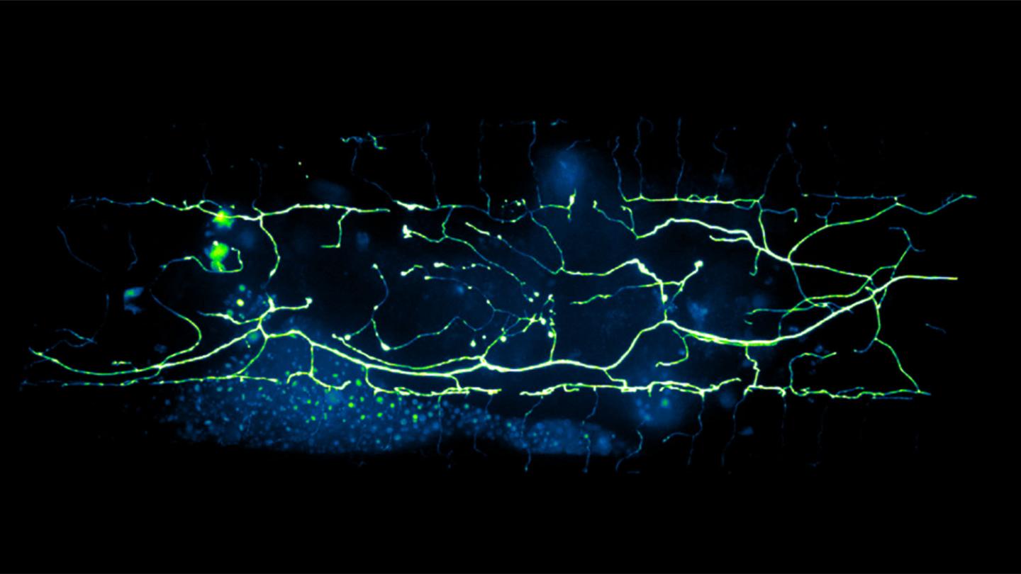 Map of a PVD Neuron