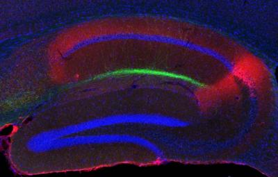 Island Cells Project to the Hippocampal CA1 Region