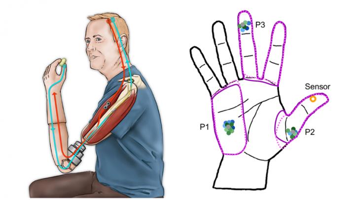 Neuroprosthetic Device