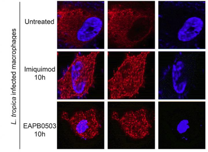 Advancement in Drug Therapies May Provide New Treatment Options for Cutaneous Leishmaniasis Patients